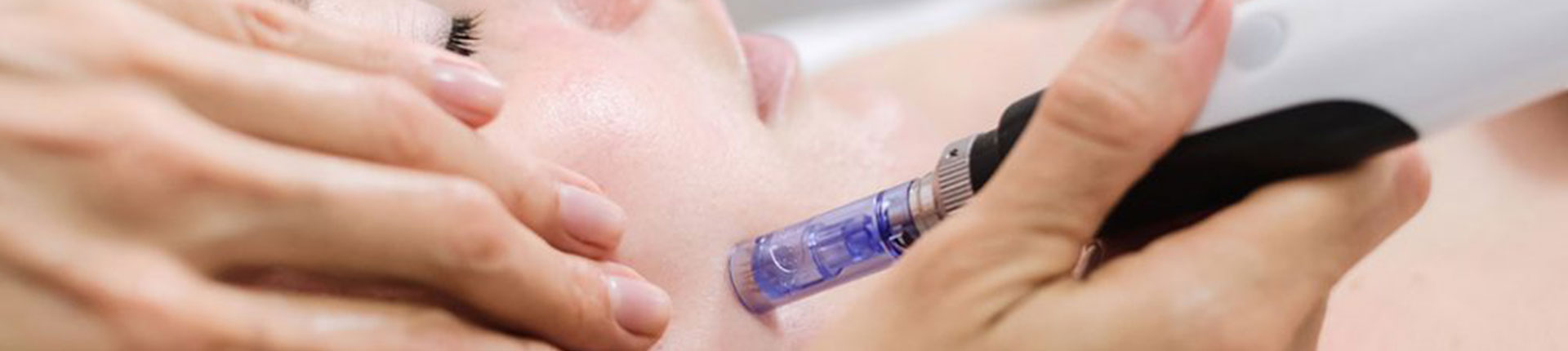 A woman is having microneedling treatment